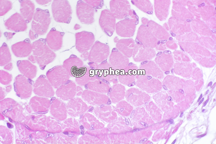 Tétard muscles en CT x125 - gryphea.com